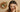 Top Dry Itchy Scalp Remedies for Instant Relief in 2025