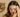 Top Dry Itchy Scalp Remedies for Instant Relief in 2025