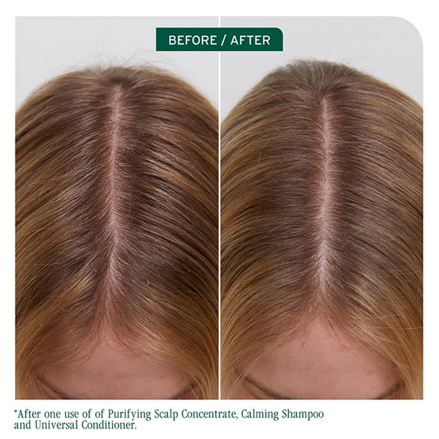 Biolage Scalp Sync Calming Shampoo - On Line Hair Depot