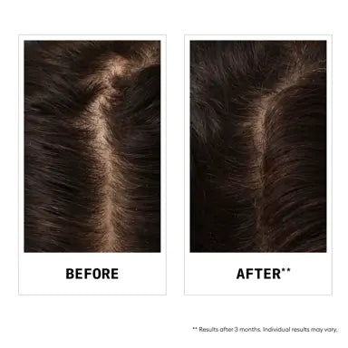 Nioxin Hair Fall Defense Shampoo - Shampoo for Hair Loss 240ml - On Line Hair Depot