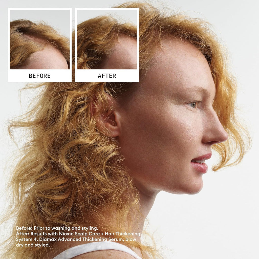Nioxin System 4 Scalp & Hair Thickening Treatment for colored hair with progressed thinning - On Line Hair Depot
